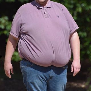 Obezite cerrahisine yeni kriterler getirildi