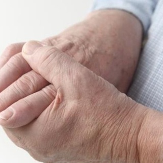 ‘Romatoid Artrit’ nedir ve tedavi yolları nelerdir?, Nusaybin Medya