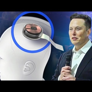 Elon Musk duyurdu: Beynine çip takılan ilk insan…