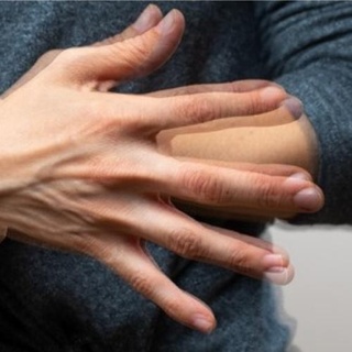 Parkinson belirtileri nelerdir?