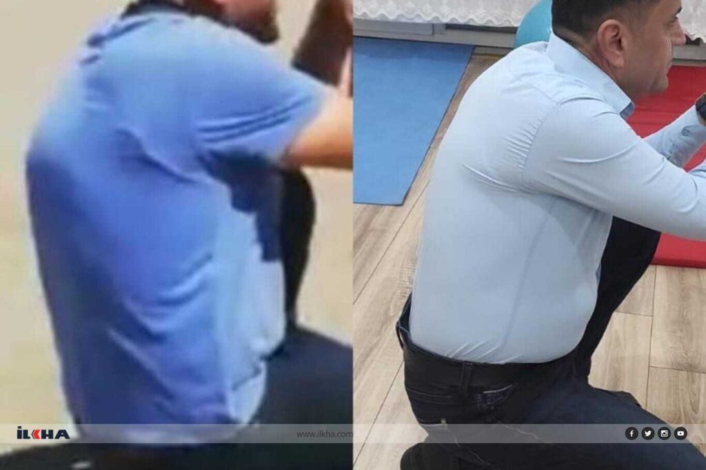 Postür bozukluğu nedir, tedavisi süreçleri nelerdir